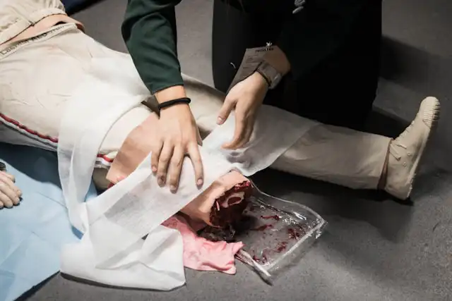 Los Angeles Amputation Accident Attorney